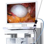 Laparoscope andoskop